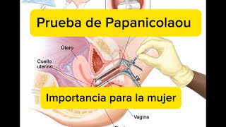 Papanicolaou o prueba citológica Su importancia para la mujer [upl. by Norword]