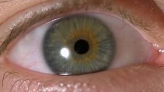 My Iris Wobbles  Eye In Slow Motion [upl. by Katina467]