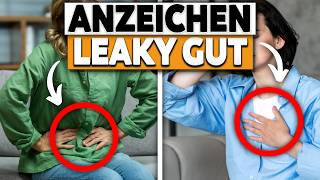 BAUCHSCHMERZEN  So kannst du das LEAKY GUT SYNDROM los werden [upl. by Acemahs701]