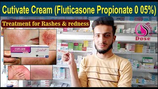 Cutivate Cream Fluticasone Propionate 0 05  Uses Side Effects Application  O Beauty Dose [upl. by Aicerg699]