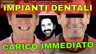 Impianti Dentali a Carico Immediato [upl. by Liek]