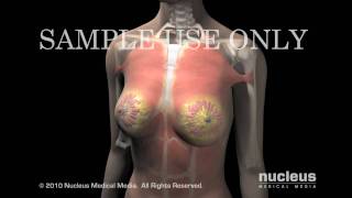 Breast Cancer Anatomy of the Breast [upl. by Caundra765]