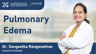 Pulmonary Edema By Dr Sangeetha Ranganathan General Practitioner [upl. by Jehanna]