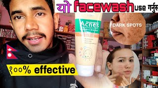 यो Acnes Facewash किन लगाउने  Acnes Facewashको फाइदाहरु के के छन  Cosmetic Nepal [upl. by Laup322]