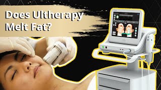 Does Ultherapy Melt Fat  Radium Medical Aesthetics [upl. by Ardnasac394]