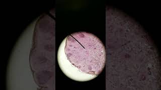 Mesenchyme and Connective tissue proper histology [upl. by Johny]