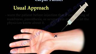 Carpal Tunnel Injection  Everything You Need To Know  Dr Nabil Ebraheim [upl. by Adiam715]