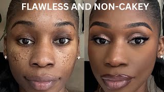 PITTED ACNE SCAR MAKEUP TUTORIAL STEP BY STEP ICEPICK SCARSBOXCAR SCARSCRATERS [upl. by Cathrin]