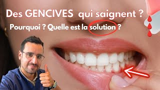 Explication GENCIVE qui SAIGNE  la solution [upl. by Sprung]