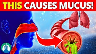 Top 10 Diseases That Cause Mucus  MUST Avoid for Respiratory Health [upl. by Dibri]