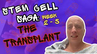 STEM CELL SAGA The Transplant  HARDEST thing I’ve ever done [upl. by Cristy]