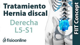 Tratamiento de la hernia discal L5 y S1 derecha o quinta lumbar y sacro [upl. by Niltyak798]