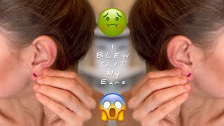 What To Do If You Have a Ear BLOWOUT  Stretched Ears [upl. by Carlick293]