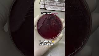 Próteus spp 🧫🧫🧫 Bacteriologia microbiologia [upl. by Neellok]