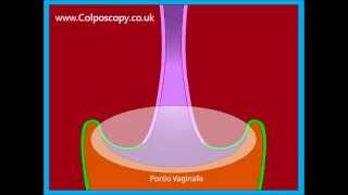 Anatomy of the cervix [upl. by Rockel]