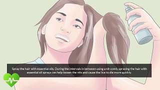 how to remove nits from hair  Lice Treatment [upl. by Amye389]