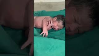 Muconium Aspiration syndrome baby trending beautiful babycare beautiful babycare cutebaby [upl. by Dachy]