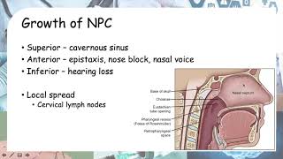 Nasopharyngeal cancer [upl. by Stavros845]