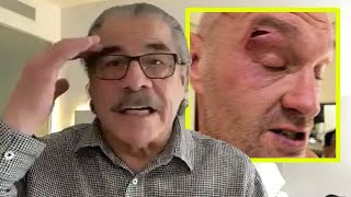 TYSON FURY NEEDS A WORLDCLASS CUTMAN  Legendary Stitch Duran READY TO HELP vs Usyk [upl. by Undis]