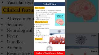 Cerebral malaria by Imran Yaseen [upl. by Cilla]