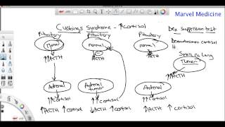 Cushings syndrome and the Dexamethasone suppression test [upl. by Wayolle]