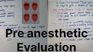 Preanesthetic Evaluation  Anesthesia dene ke Pehle kya kya checkup karte hAllrounderdoctorfalit [upl. by Ainos230]