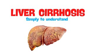 Liver Cirrhosis  Overview [upl. by Ardaed413]