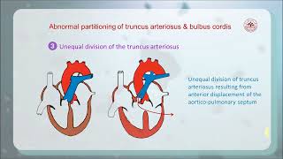 8 4 Partitioning of truncus arteriosus and bulbus cordis 齐鲁医学院 [upl. by Kwan]