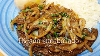 HÍGADO ENCEBOLLADO [upl. by Lac538]