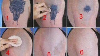 How to Remove a Tattoo without Laser at Home [upl. by Iemaj]