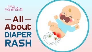 Diaper Rash in Babies – Symptoms Causes and Remedies [upl. by Stroup]