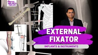 External Fixator Implants amp Instruments [upl. by Zenas533]