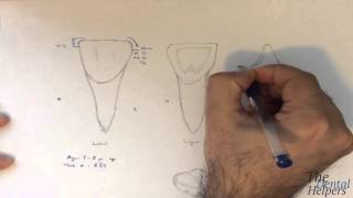 Dental Anatomy Maxillary Central Incisor [upl. by Labotsirc]