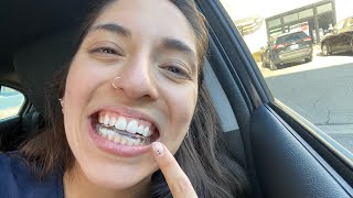 TMJ orthotic splint therapy 4 month update [upl. by Leelahk417]