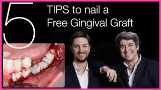 🇺🇸 5 Tips to nail a Free Gingival Graft  Dental Implants [upl. by Ellevel]