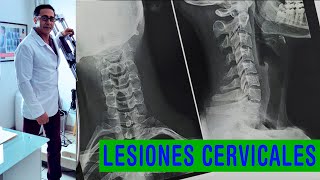 Conoce diferentes tipos de desviaciones y lesiones cervicales [upl. by Kenwood]