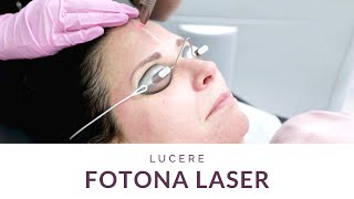 Luceres Fotona Laser Treatment [upl. by Annaohj33]