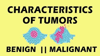 Characteristics Of Tumor Pathology  Characteristics Of Tumor Cells medicine pathology [upl. by Dustan]