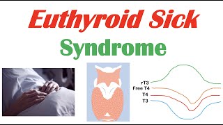 Euthyroid Sick Syndrome Nonthyroidal Illness Syndrome Causes Symptoms Diagnosis Treatment [upl. by Rein]