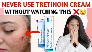 How to use TRETINOIN CREAM In Tamil TRETINOIN MISTAKES IN TAMIL [upl. by Lem]