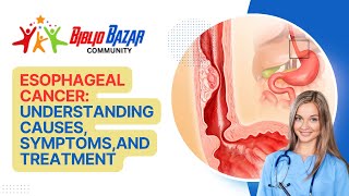 🩺 Understanding Esophageal Cancer Symptoms Treatment and Care 🩺 [upl. by Schaffer]