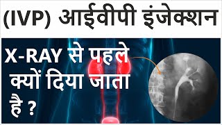 Intravenous Pyelogram in Hindi  Intravenous Pyelogram Procedure  IVP Test for Kidney [upl. by Haida]