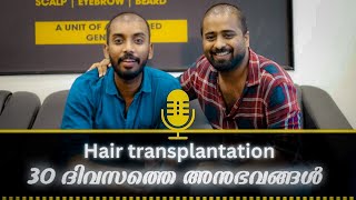 Hair Transplant After 30 days  ഈ ദിവസങ്ങളിൽ എന്തൊക്കെsambhavichu  safദിവസങ്ങളിൽ [upl. by Artiek458]