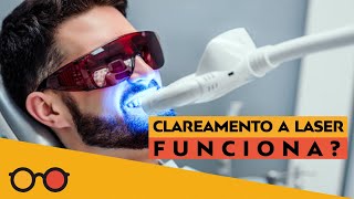 Clareamento Dental a Laser funciona l Plantão de Dúvidas [upl. by Onairda]