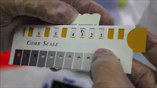 VacciCheck  Interpreting the VacciCheck Test Results [upl. by Edea]