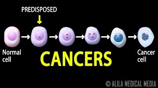 Cancer How Cancer Starts How Cancer Spreads Where and Why Animation [upl. by Christianna]