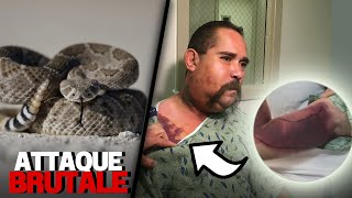 Cet Homme Meurt à lHôpital Après Une Brutale Attaque De Serpent à Sonnette [upl. by Godewyn]