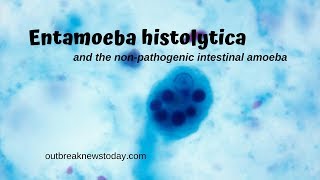 Entamoeba histolytica and the nonpathogenic intestinal amoeba [upl. by Zita]