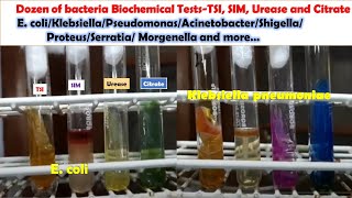 Various Bacteria Biochemical Tests E coli KlebsiellaPseudomonasAcinetobacterProteusMongenella [upl. by Natalee]