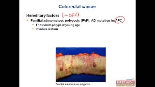 Colorectal carcinoma GIT pathology video part 6 from USMLE First Aid Step One [upl. by Isaacson]